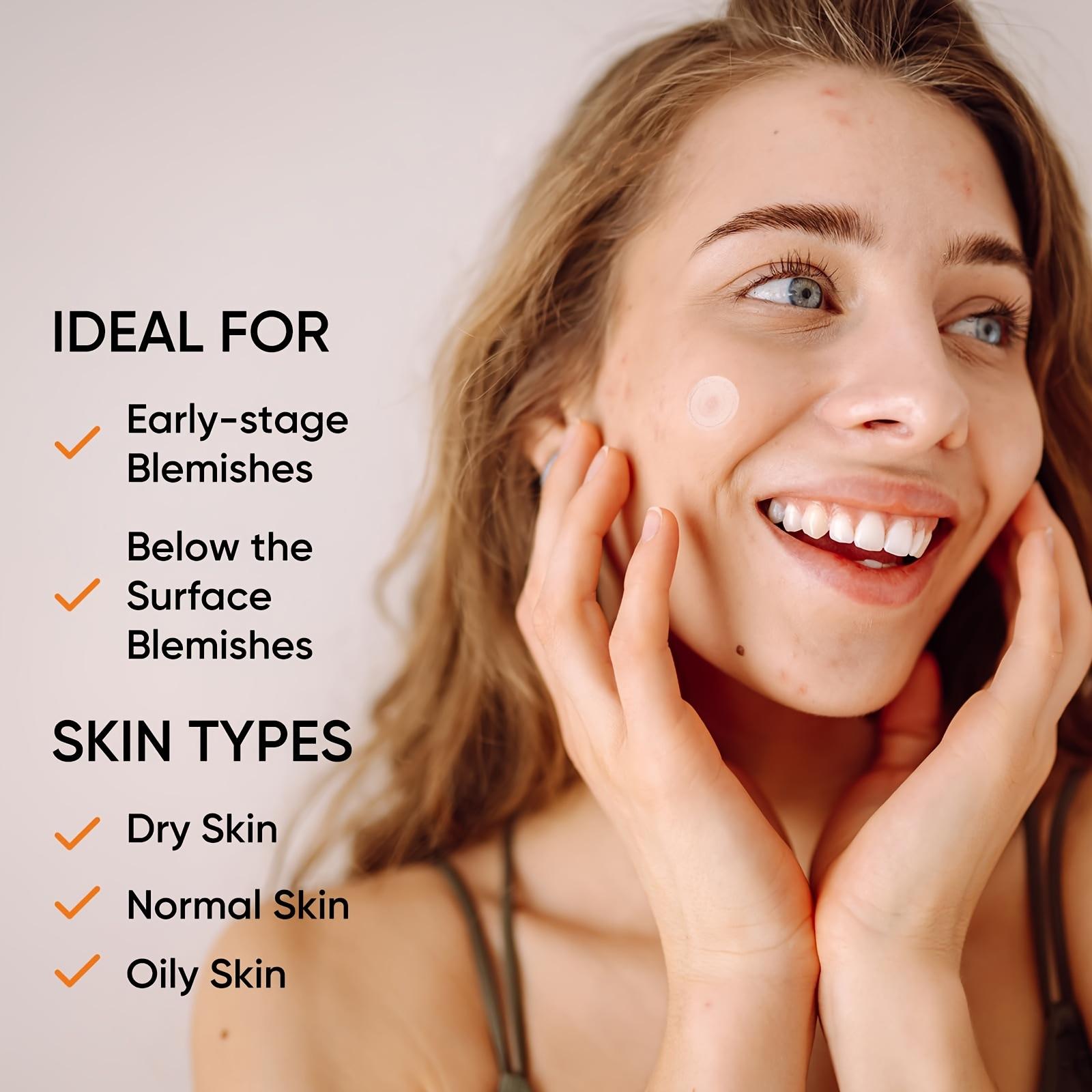 Duże hydrożelowe plastry na tr – Xl Skincare recenzja i cena