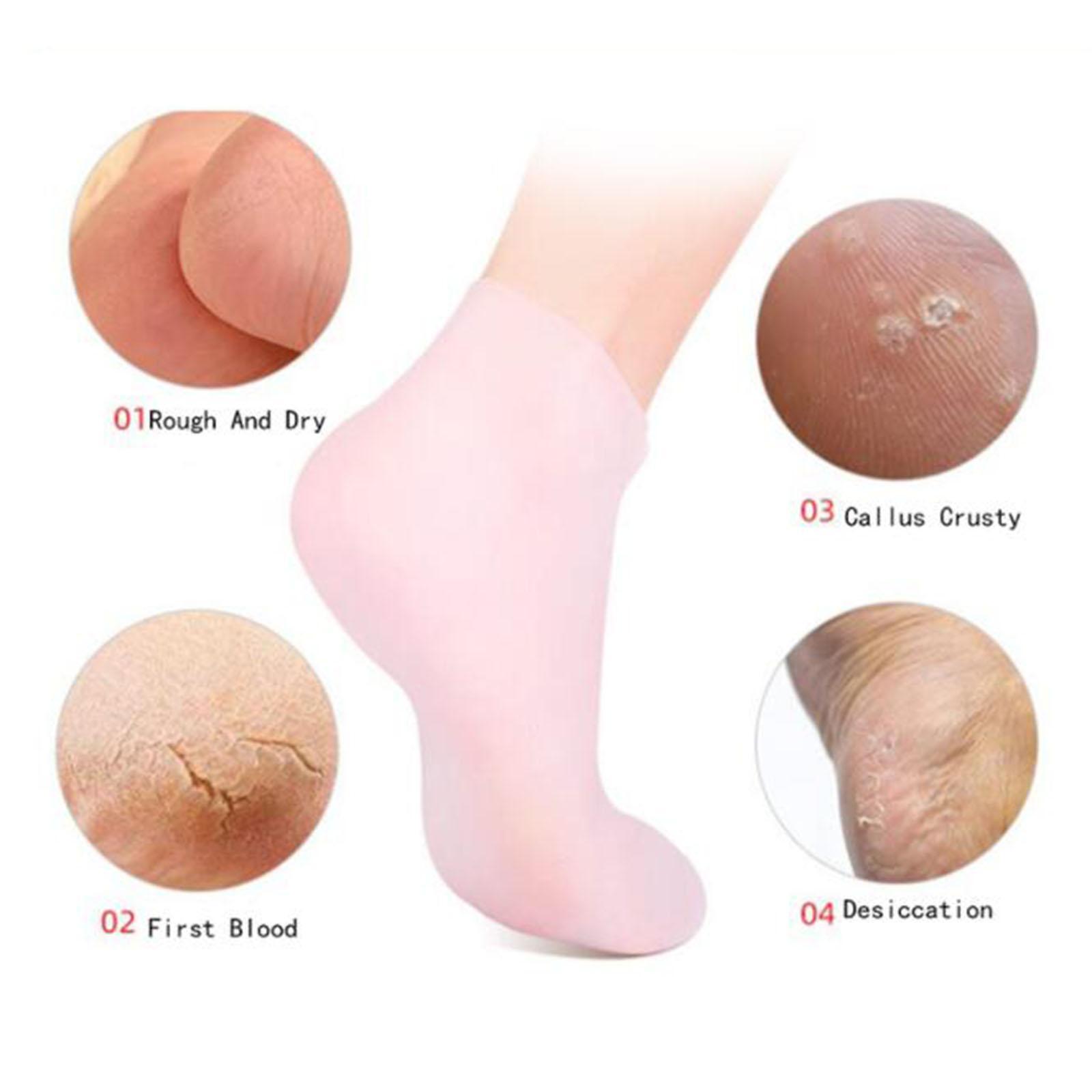 Miękkie silikonowe skarpetki ż – Xl Skincare recenzja i cena