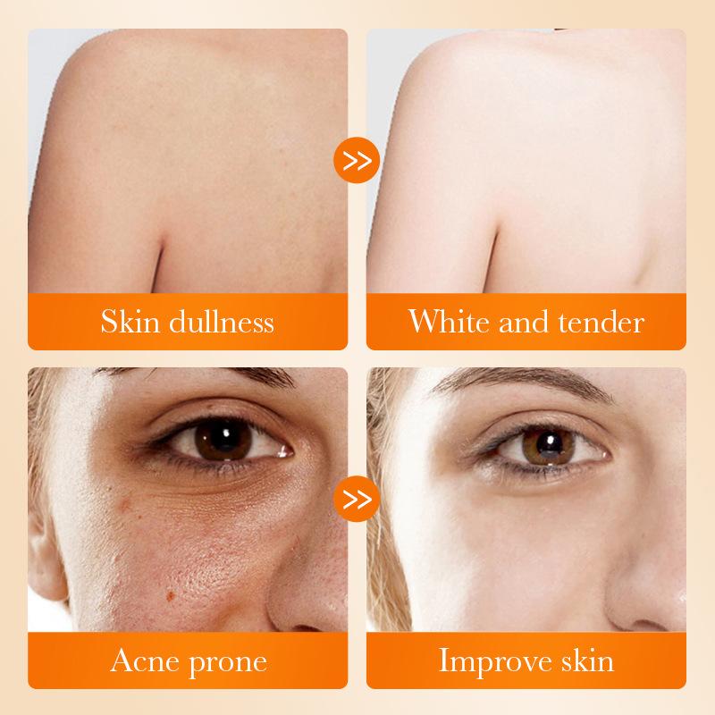 1 szt. SADOER Mydło do twarzy  – Kojic Acid Soap recenzja i cena